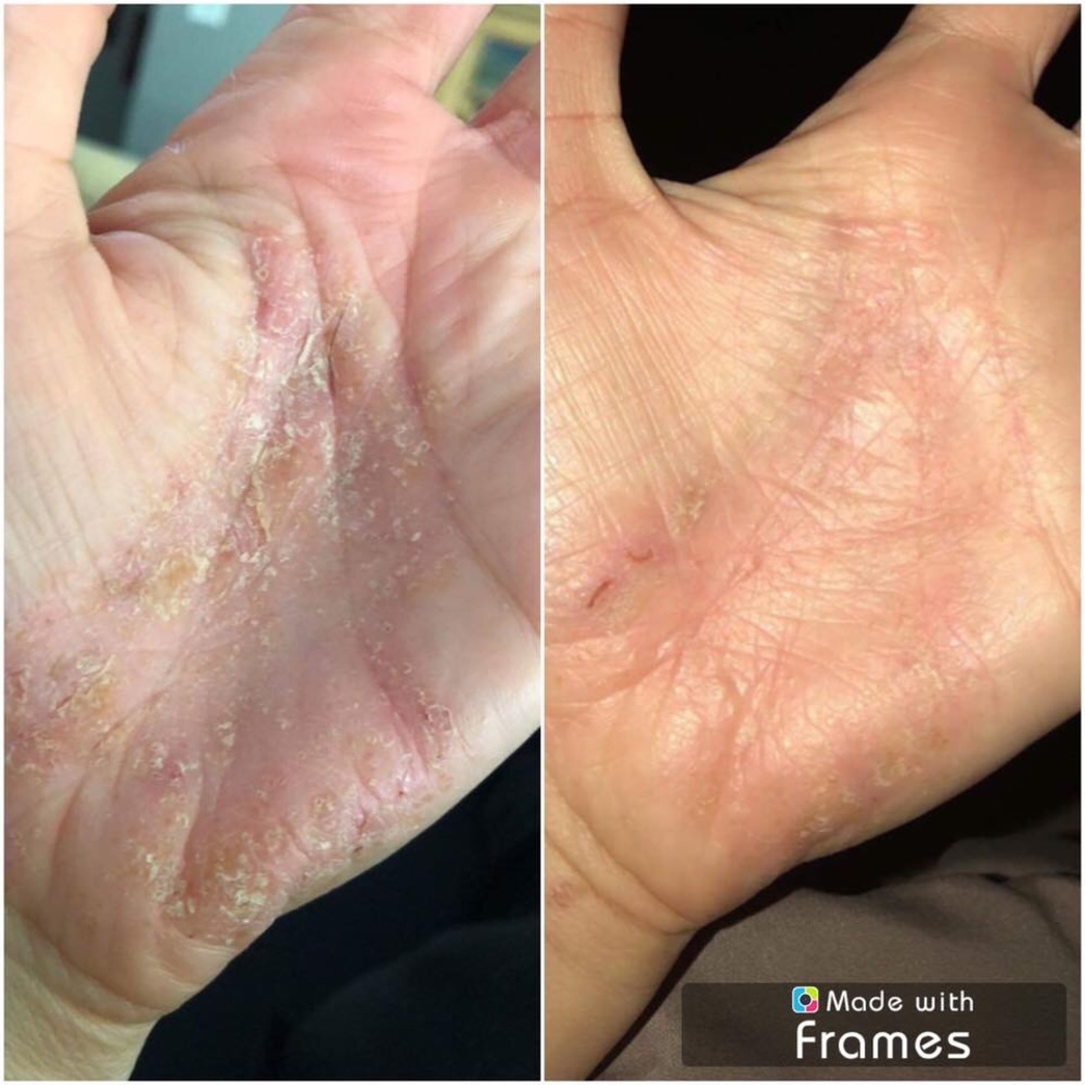 Monat Rejuveniqe Oil Intensive